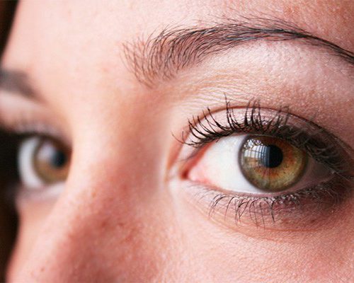 Ocular Rosacea