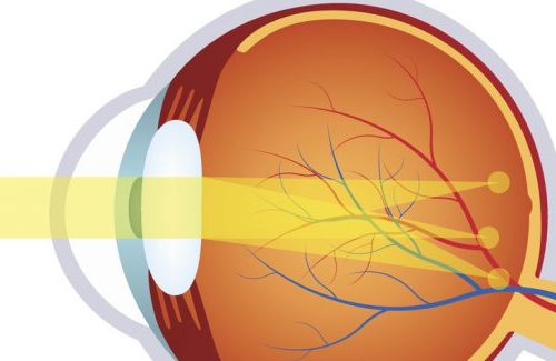 how-to-know-if-i-you-have-astigmatism-700x325 Astigmatism